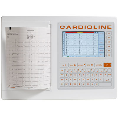 Electrocardiogramme