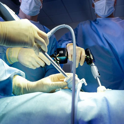 Dispositif chirurgicaux